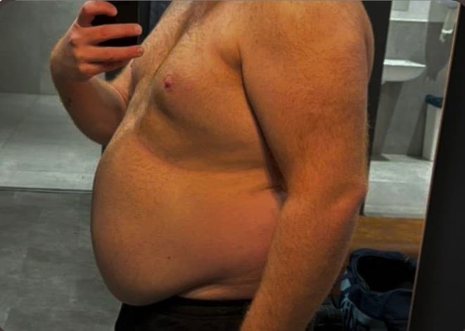 Before transformation